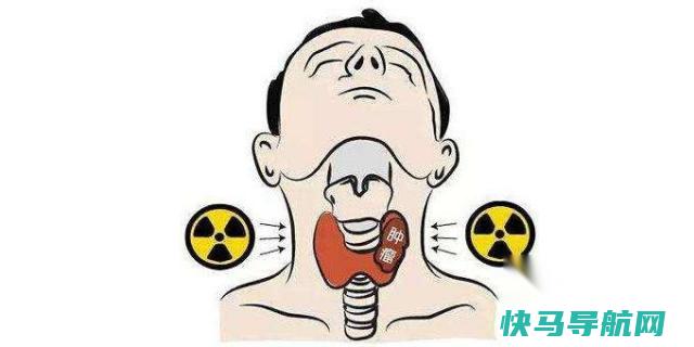 患了甲状腺结节的人饮食禁忌，什么食物不能多吃？ 第3张